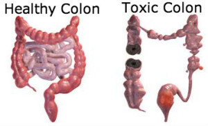 healthy-vs-toxic-colon